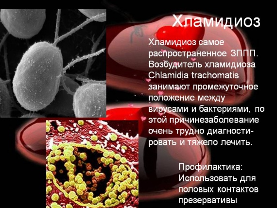 Хламидиоз