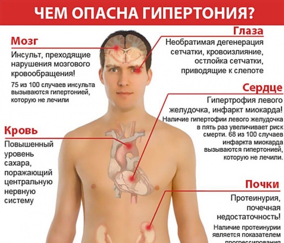 Чем опасна гипертония? Чем опасна гипертония?